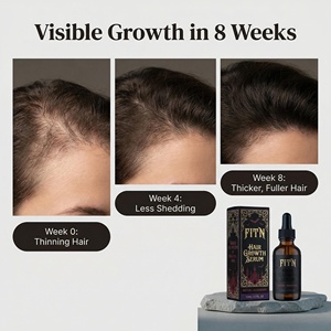 Sérum Capillaire Croissance Cheveux à la Biotine, au Romarin et aux Peptides – Dévoilez le Secret des Cheveux Magnifiques pour des Cheveux Plus Épais et Plus Forts – Marque Privée, Vente en Gros - Product Image 4