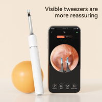 Otoscope numérique intelligent sans fil WIFI 3 en 1, kit de pinces pour nettoyer les oreilles, caméra, otoscope, outil de retrait du cérumen