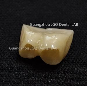 Prothèses dentaires en <span class=keywords><strong>zircone</strong></span> toutes les couronnes et ponts en céramique de haute qualité, bonne biocompatibilité et prix abordable - Product Image 3