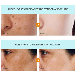 Crema corporal iluminadora de tono de piel Corrector de manchas oscuras recientemente desarrollada - Product Image 3