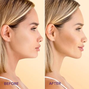 Masque en feuille pour le cou au collagène hydratant, à l'extrait de thé vert, de qualité supérieure, pour le soin de la peau à domicile, traitement anti-rides et raffermissant pour le visage - Product Image 6