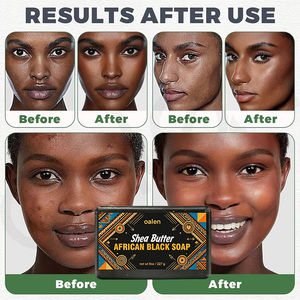 <span class=keywords><strong>Savon</strong></span> noir africain Luxfume avec beurre de karité, nourrit et adoucit la <span class=keywords><strong>peau</strong></span>, nettoie en profondeur les pores, contrô<span class=keywords><strong>le</strong></span> <span class=keywords><strong>le</strong></span> sébum, végétalien - Product Image 2