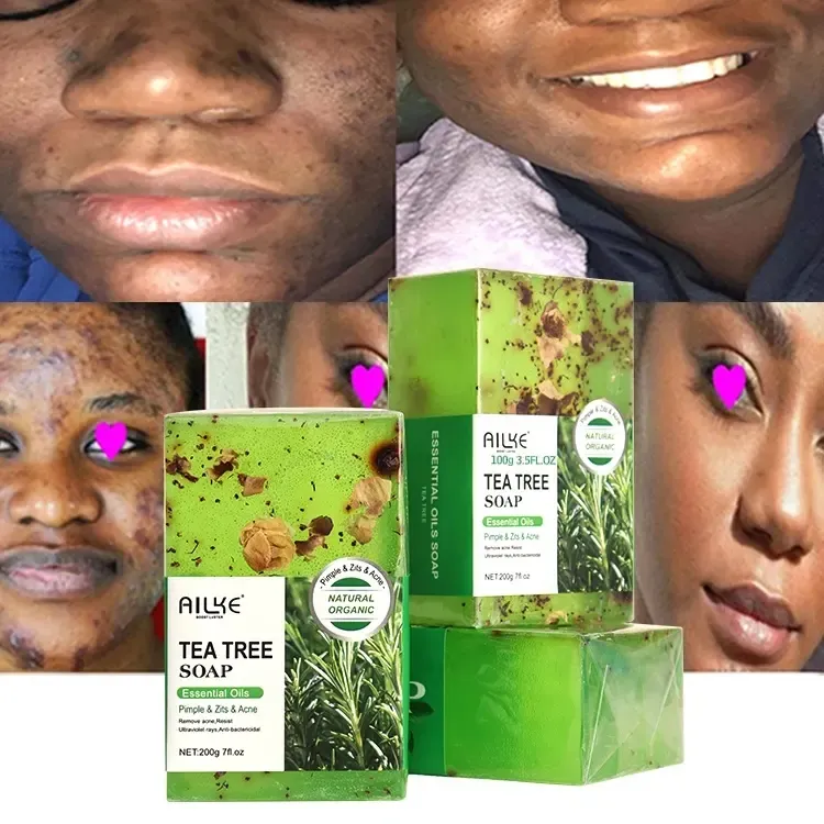 AILKE Personalizado Espinha E Espinhas Remoção De Óleo Da Pele Anti Envelhecimento Tratamento Tea Tree Facial Acne Bar Sabonete Artesanal