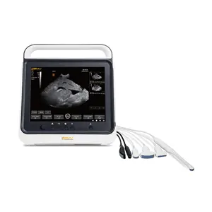 Portable Full Touch Screen B/W Ultrasound System Medical Portable Laptop Style Black and White Ultrasound Scanner for Body Scans