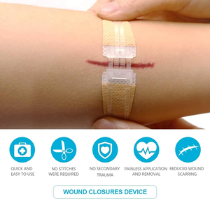 อุปกรณ์ปิดแผลฉุกเฉิน ชุดอุปกรณ์ปิดแผลด้วยโอโซนพร้อมแถบซิปสติทช์ ชุดเย็บแผล แผ่นปิดแผลชนิดซิปสติทช์ สำหรับซ่อมแซมแผลระดับ Class I ผลิตแบบ OEM - Product Image 4