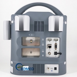 Produits les plus vendus : Échographe ophtalmologique portable en mode A/B pour usage hospitalier ophtalmique EUS400 - Product Image 4