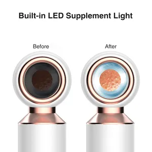 Point Noir Black Head Remover LED Light Visual Vacuum Blackhead Facial Pore Remover With Magnifier