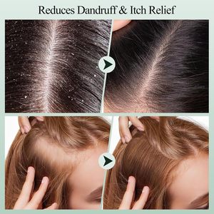 Tratamiento Capilar 2 en 1, Exfoliante y Champú con Aceite de Menta y Romero para Limpiar en Profundidad y Eliminar la Acumulación - Product Image 4