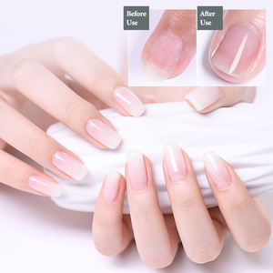 Soin des <span class=keywords><strong>ongles</strong></span> : <span class=keywords><strong>Huile</strong></span> à cuticules bio personnalisée aux herbes, prévient les peaux mortes, application précise sans gouttelettes, stylo applicateur <span class=keywords><strong>d</strong></span>'<span class=keywords><strong>huile</strong></span> à cuticules - Product Image 4