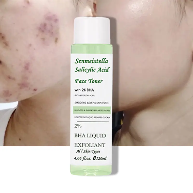 カスタムロゴ120ml Salicylic Acid Anti Acne Face Fade Acne Scar Shrink Pores Glowing Salicylic Acid Skin Toner