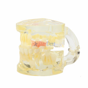 Modèle de dents dentaires avec flipper <span class=keywords><strong>amovible</strong></span>, modèle de prothèse dentaire transparente pour l'enseignement - Product Image 5