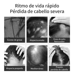 Crecimiento del cuidado del cabello Tratamiento eficaz contra la pérdida de jengibre natural Fortalecer la raíz del cabello <span class=keywords><strong>Crec</strong></span> - Product Image 2