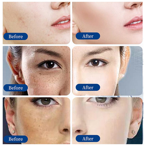 Polvere Liofilizzata di Acido Ialuronico e Vitamina C per Uso Domestico e Professionale - Trattamento Viso Idratante e Anti-Età - Product Image 4