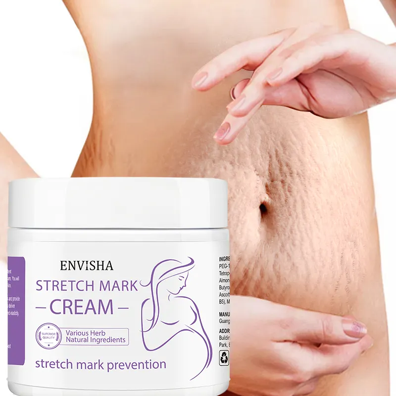 Oem Natuurlijke Anti Striae Crème Zwangerschap Striae Stretch Mark Verwijdering Crème Voor Zwangere Vrouwen Benen En Dijen