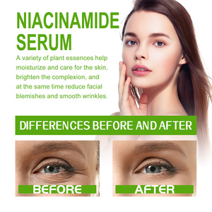 Hydratant naturel brillant soins de la peau blanchissant hydratant boutons foncé noir tache dissolvant crème pour le visage - Product Image 5