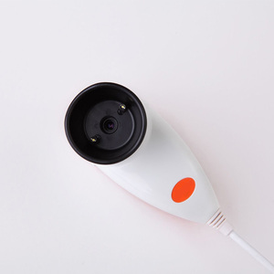 MY-V041A 5,0 Mega píxeles de alta resolución de iridología ojo analizador iris iridology camera de la máquina - Product Image 3