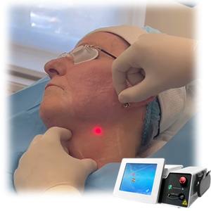 Laser portatif liposucciondiode laser 1470nm 980nm pour le corps de chirurgie amincissant la machine médicale laser liposuccion - Product Image 2