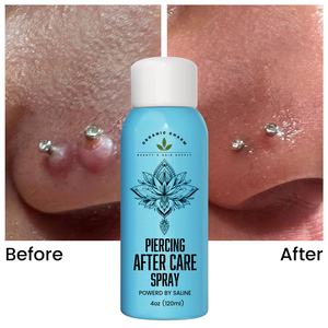 Profession elle Großhandel Ohr Piercing Nachsorge <span class=keywords><strong>Spray</strong></span> Keloid Bump Entfernung für Permanent Make-up Nachsorge - Product Image 3