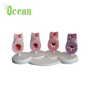 Modè<span class=keywords><strong>le</strong></span> de bronchies asthmatiques normales, modè<span class=keywords><strong>le</strong></span> médical de pathologie trachéale pour la publicité, l'éducation <span class=keywords><strong>et</strong></span> la démonstration - Product Image 1