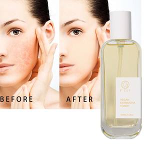 Kombucha Etiqueta Privada <span class=keywords><strong>Natural</strong></span> <span class=keywords><strong>Facial</strong></span> Elixir Mist Tonic Organic Skin Hydrating Toner - Product Image 5