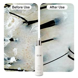 Champú para <span class=keywords><strong>el</strong></span> cabello con grasa de 300Ml para <span class=keywords><strong>cuero</strong></span> <span class=keywords><strong>cabelludo</strong></span> graso Etiqueta privada Champú purificante de 300Ml para reducir <span class=keywords><strong>el</strong></span> exceso de aceite <span class=keywords><strong>en</strong></span> <span class=keywords><strong>el</strong></span> <span class=keywords><strong>cuero</strong></span> <span class=keywords><strong>cabelludo</strong></span> - Product Image 4