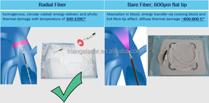 ¡Gran Oferta! Nuevos Productos: Láser de Diodo 980nm+1470nm para Tratamiento de Várices EVLT, Máquina Endovenosa para Clínicas - Product Image 6