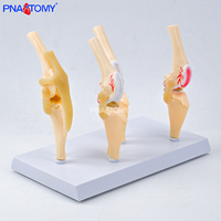 Modèle d'anatomie du squelette animalier du genou canin à 4 étapes pour chien atteint d'arthrose, cadeau médical, équipement éducatif, outil pédagogique pour animaux de compagnie