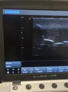 แบบจำลองการเจาะด้วยอัลตราซาวนด์สำหรับการฝึกอบรมการรักษาด้วยอัลตราซาวนด์บริเวณเต้านม พร้อมเนื้องอกสีเหมือนผิวหนัง - Product Image 4