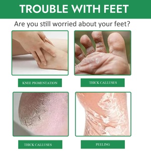 Chân Callus loại bỏ phun chăm sóc bàn chân làm mềm dưỡng ẩm nuôi dưỡng loại bỏ da chết tẩy tế bào chết lột sương - Product Image 2