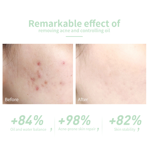 เซรั่มลดรอยแดงจากสิว LANBENA ขนาด 30 มล. สำหรับขายส่ง - Product Image 6