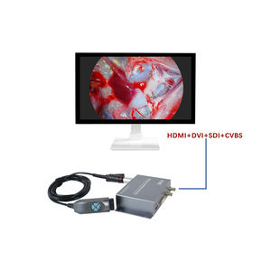 Tuyou 1080P Endoscoop Converter Ultra-Lage Latentie Draagbare Medische Beeldvorming Ent & Huisdier Chirurgie - Product Image 2