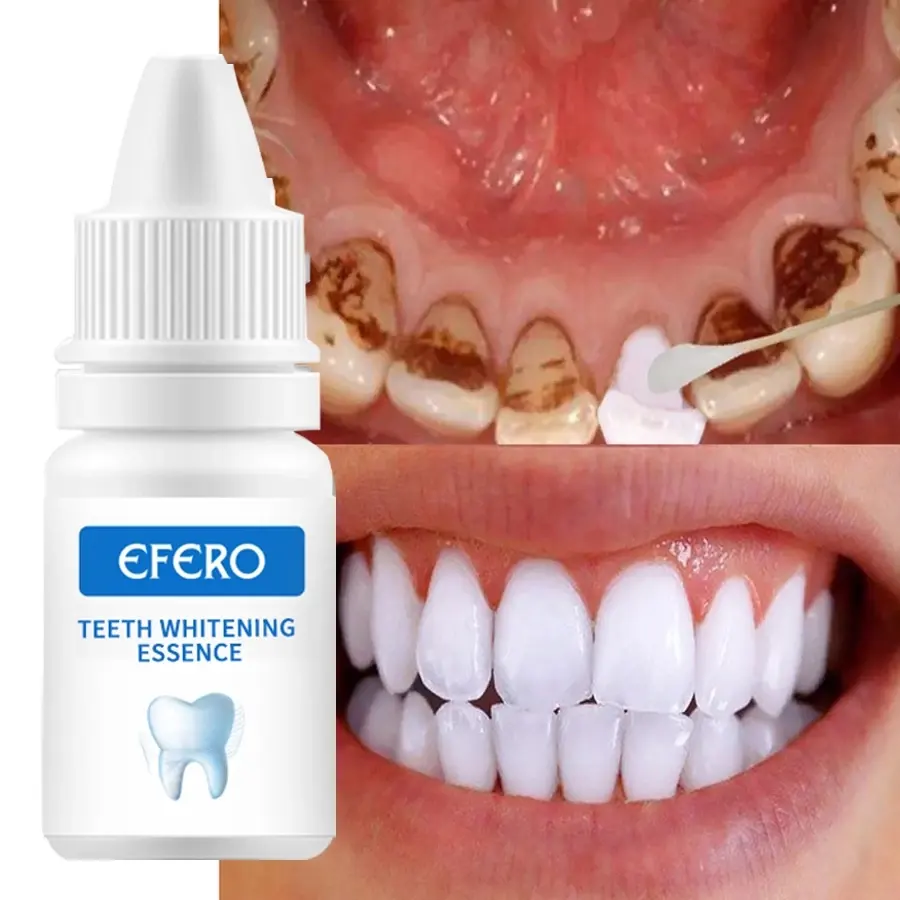 EFEROプラークの汚れを取り除く歯の漂白ツールデンタルケア歯磨き粉歯のホワイトニング口腔衛生洗浄血清
