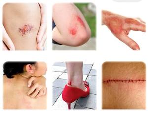 저 알레르기 멸균 인공 피부 드레싱 대형 하이드로 콜로이드 상처 드레싱 패치 바디 패치 - Product Image 4