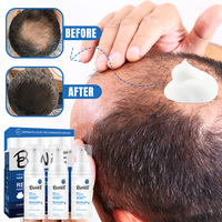 BUNEE Graisse Mousse Perte De Cheveux Repousse Mousse Croissance Des Cheveux nutrafo femmes équilibre croissance des cheveux suppléments
