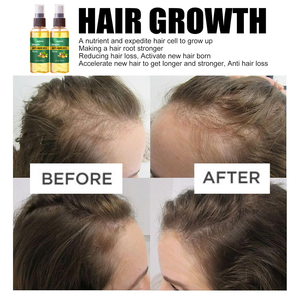 <span class=keywords><strong>Spray</strong></span> de soin capillaire au gingembre biologique Luxfume, huile de croissance capillaire anti-chute, brume nourrissante pour la <span class=keywords><strong>repousse</strong></span> des <span class=keywords><strong>cheveux</strong></span> au gingembre - Product Image 6