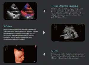 Appareil d'échographie Doppler couleur 4D Sonoscape P12Elite avec grand écran pour l'obstétrique / la cardiologie / l'abdomen - Product Image 5