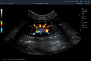Ecógrafo Médico Portátil, Ultrasonido Doppler Color, Máquina de Ultrasonido Veterinario - Product Image 3