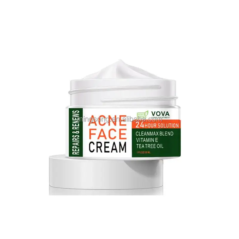 OEM efficace crema per la rimozione dell'acne macchie per il trattamento dell'acne controllo dell'olio pori termoretraibili sbiancamento crema idratante per l'acne cura della pelle