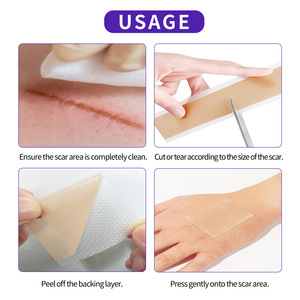Rouleau de ruban adhésif en gel réutilisable de qualité supérieure pour la couverture des cicatrices, avec logo personnalisé - Product Image 2