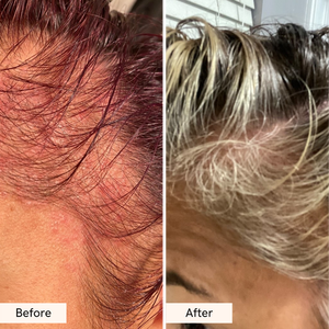 Lance Private Label <span class=keywords><strong>tonico</strong></span> per capelli 100% <span class=keywords><strong>naturale</strong></span> vegano promuovere la crescita dei capelli Anti perdita di importazione rottura nutre il cuoio capelluto per capelli sani - Product Image 5