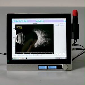 Equipo <span class=keywords><strong>de</strong></span> Diagnóstico por Ultrasonido Oftálmico A-Scan B-Scan ABS-500 para Hospitales Oftalmológicos y Clínicas <span class=keywords><strong>de</strong></span> Oftalmología - Product Image 2