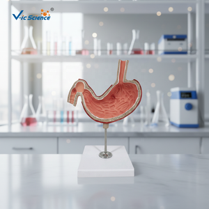 Modelli Anatomici per l'Insegnamento Medico: Modello di Stomaco con <span class=keywords><strong>Ulcere</strong></span>, Modello Anatomico del Sistema Digestivo - Product Image 1