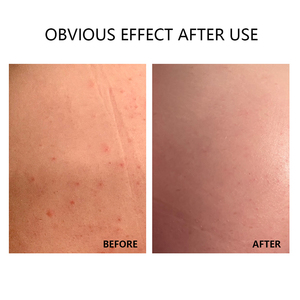 Roll-on Pereda Nyeri Alami OEM Kekuatan Profesional dengan Menthol untuk Nyeri Otot dan Sendi Lutut, Punggung, Leher, Pereda Nyeri Cepat dan Dingin - Product Image 5