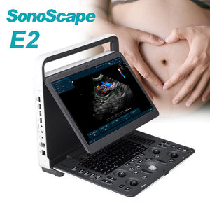 SonoScape E2 Ultrasonik Kualitas Tinggi dengan Sensor Ultrasonik - Product Image 6