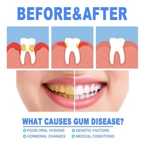 Gel réparateur dentaire EELHOE, répare les gonflements et la douleur des gencives, nettoyage en profondeur des taches dentaires, gel de traitement des caries - Product Image 4