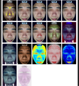 Équipement de beauté prêt à expédier, <span class=keywords><strong>scanner</strong></span> de peau intelligent à IA, 8 modes d'éclairage, analyse faciale <span class=keywords><strong>3D</strong></span> pour l'acné, les pigments, les pores, les rides - Product Image 5