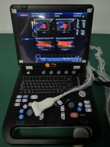 Échographe numérique complet, échographie cardiaque, Doppler couleur, machine à ultrasons 2D 3D 4D - Product Image 4