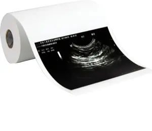 110S x 20M ultrasound printer paper 110S/110HG for ultrasound standard type 1 UPP110S