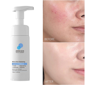Nettoyant moussant doux végétalien biologique en gros, nettoyant pour le visage, contrôle du sébum, acide aminé, anti-rides, contrôle de l'acné du visage - Product Image 1