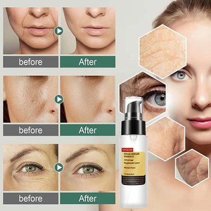 Yurhersu Bộ chăm sóc da ốc sên Hàn Quốc Bộ chăm sóc da ốc sên làm trắng da chống nhăn Collagen dưỡng ẩm chăm sóc da Ốc Sên - Product Image 4